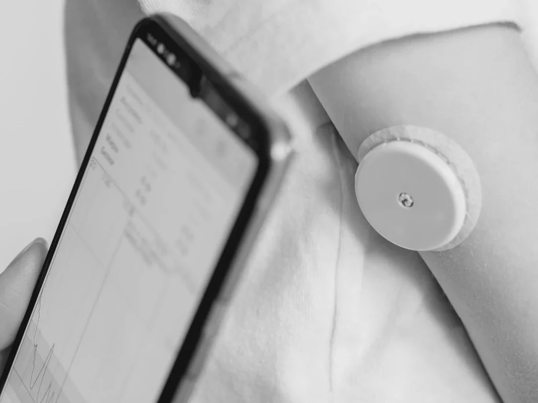 Een glucosesensor op de bovenarm